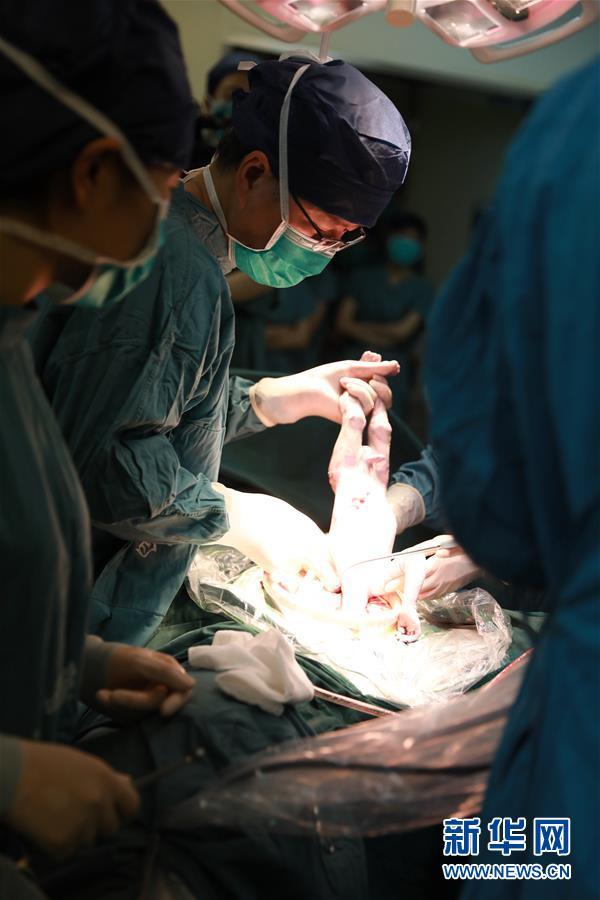 China's first baby born to a mother with a transplanted uterus. [Photo: Xinhua]