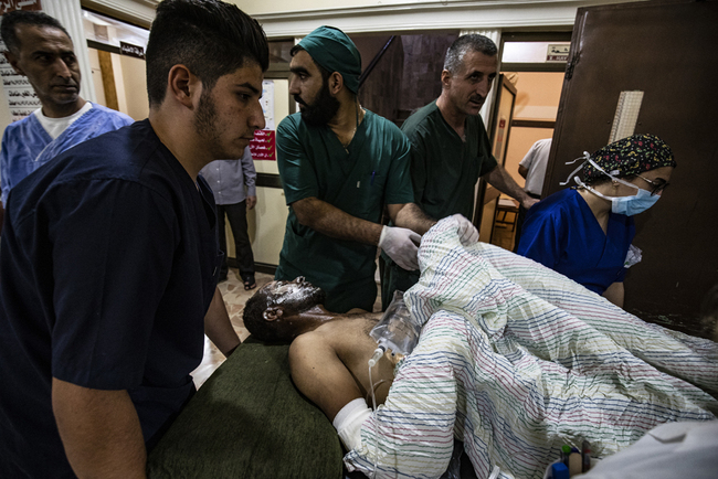 A wounded man receives treatment at a hospital in the northeastern Syrian Kurdish city of Qamishli on October 13, 2019, following a Turkish air strike that hit a convoy of vehicles carrying civilians and journalists. [Photo: AFP/Delil Souleiman]